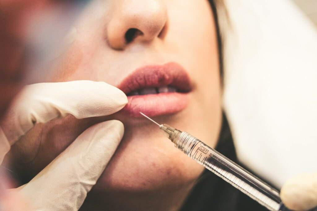 lip fillers lip fillers